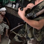 Un garçon blessé en Syrie